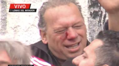 Golpearon a Sergio Berni en una protesta por el asesinato de un chofer