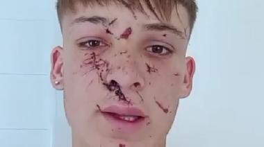 Al intentar separar una pelea, un joven de Necochea fue brutalmente golpeado en Claromecó: La familia pide justicia