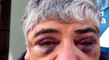 "¿Viste cómo me pegaron? Sí, pero no podemos hacer nada"