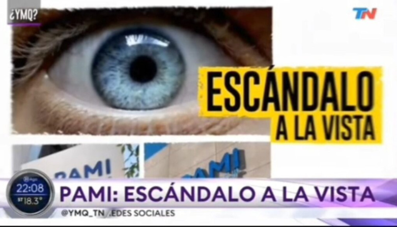 Denuncian sobreprecios millonarios en PAMI por lentes de cataratas