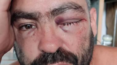 Ataque piraña: Denuncian golpiza y robo a un músico de la banda "Trasnochados"