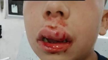 Dos adolescentes le dieron una paliza a un nene de 8 años
