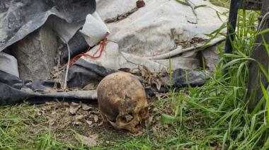 Vecino encuentra cráneo humano mientras realizaba tareas de jardinería