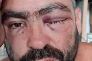 Ataque piraña: Denuncian golpiza y robo a un músico de la banda "Trasnochados"